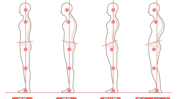 姿勢矯正で肩こり・腰痛を根本改善｜札幌市西区二十四軒の整骨院が解説