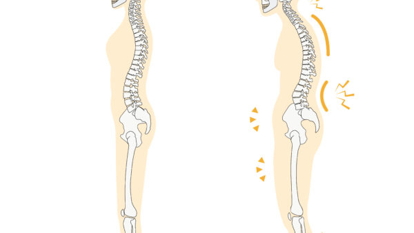 【首肩の痛み】なぜマッサージで治らない？猫背矯正が効果的な「科学的根拠」