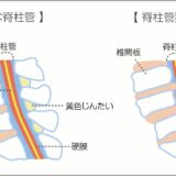脊柱管狭窄症とは？歩くと足がしびれる原因と対策｜てて整骨院二十四軒店