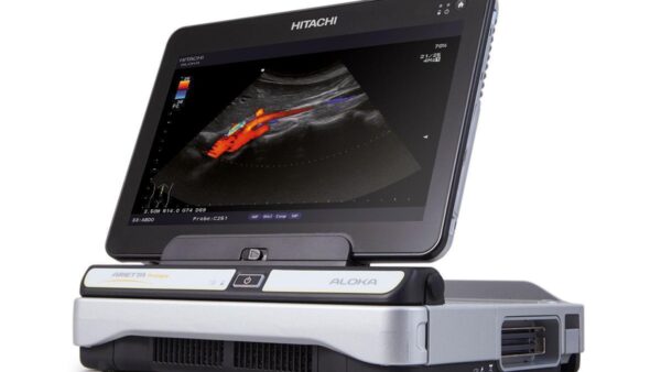 札幌市西区で安心のエコー診察｜ ケガや痛みを“見える化”する超音波観察【てて整骨院二十四軒店】